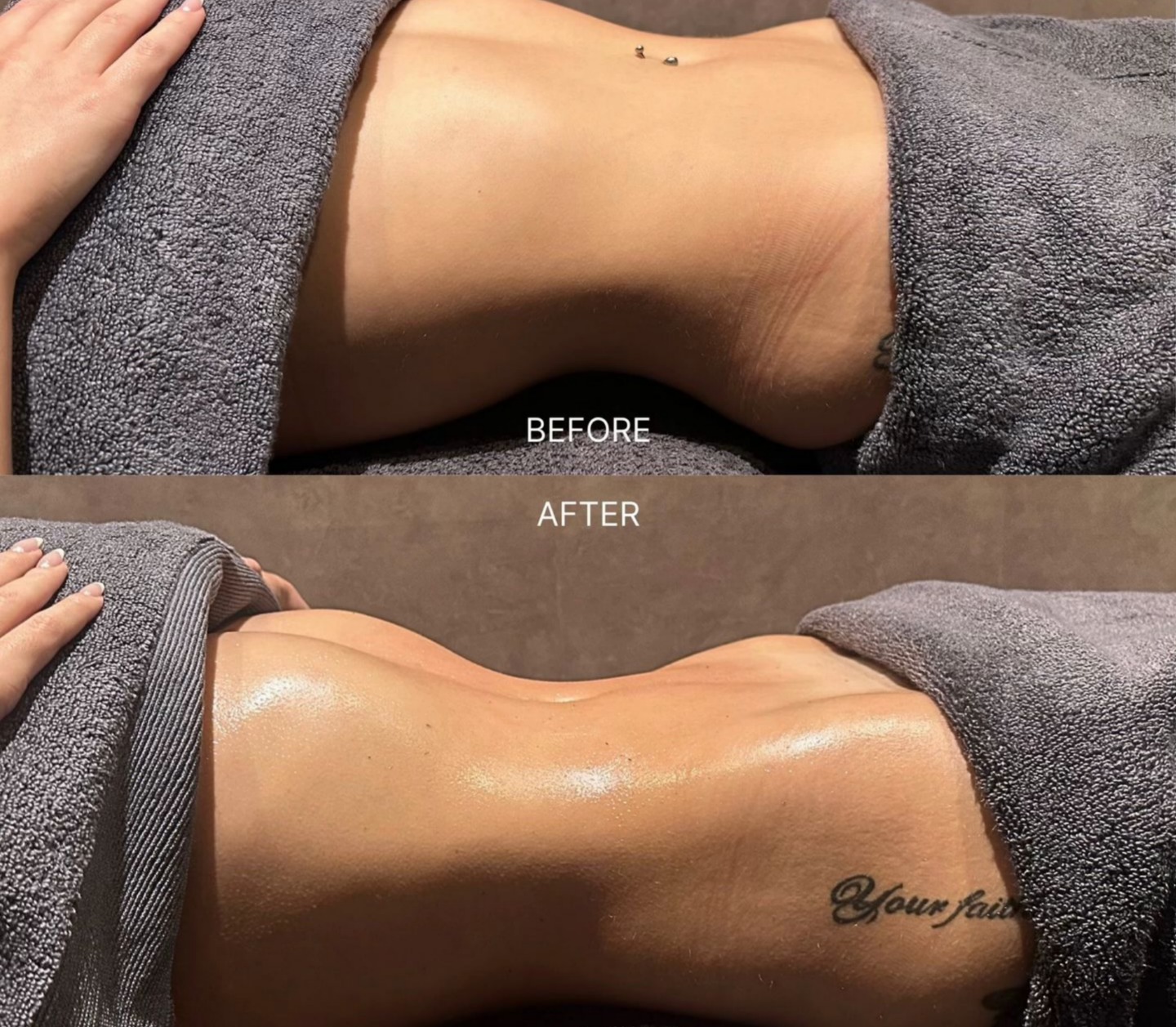 Swelling Reduction — before and after lymphatic drainage